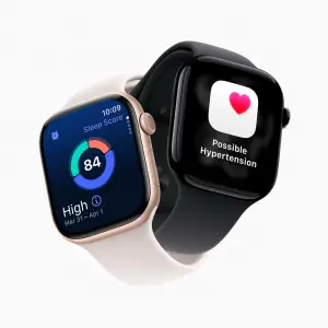 Apple Watch Series 11. (Sumber: Apple)